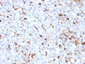 Immunohistochemical analysis of formalin-fixed, paraffin-embedded human liver using Anti-Cathepsin K Antibody [CTSK/2793]