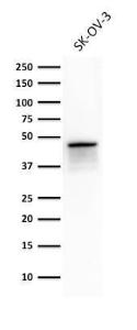 Western blot analysis of SK-OV-3 cell lysate using Anti-Cytokeratin 8 Antibody [TS1]