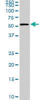 Anti-CDK8 Mouse Monoclonal Antibody [clone: 6E5]