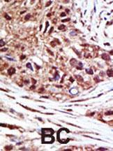 Anti-USP14 Rabbit Polyclonal Antibody (PE (Phycoerythrin))