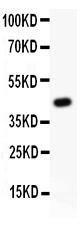 Anti-Gli1 Polyclonal Antibody