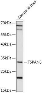 Western blot analysis of extracts of Mouse kidney, using Anti-TSPAN6 Antibody (A308089) at 1:1000 dilution