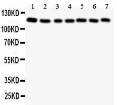 Anti-Gli1 Polyclonal Antibody