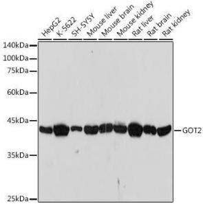 Western blot analysis of extracts of various cell lines, using Anti-FABP-1 Antibody [ARC2405] (A306930) at 1:1,000 dilution