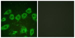 Immunofluorescence analysis of HUVEC cells using Anti-Tyrosine Hydroxylase Antibody. The right hand panel represents a negative control, where the antibody was pre-incubated with the immunising peptide