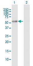 Anti-ALDH7A1 Mouse Polyclonal Antibody