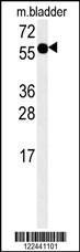 Anti-ADSSL1 Rabbit Polyclonal Antibody (FITC (Fluorescein Isothiocyanate))