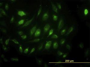 Anti-USP33 Mouse Monoclonal Antibody [clone: 5B5]