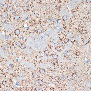 Immunohistochemistry analysis of paraffin-embedded rat brain using Anti-FABP-1 Antibody [ARC2405] (A306930) at a dilution of 1:100 (40X lens). Perform microwave antigen retrieval with 10 mM Tris/EDTA buffer pH 9.0 before commencing with IHC staining protocol