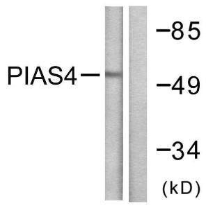 Western blot analysis of lysates from Jurkat cells using Anti-PIAS4 Antibody. The right hand lane represents a negative control, where the antibody is blocked by the immunising peptide.