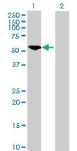 Anti-PKM Rabbit Polyclonal Antibody