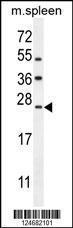 Anti-LMO4 Rabbit Polyclonal Antibody (AP (Alkaline Phosphatase))