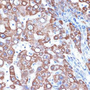 Immunohistochemistry analysis of paraffin-embedded human liver using Anti-FABP-1 Antibody [ARC2405] (A306930) at a dilution of 1:100 (40X lens). Perform microwave antigen retrieval with 10 mM Tris/EDTA buffer pH 9.0 before commencing with IHC staining protocol