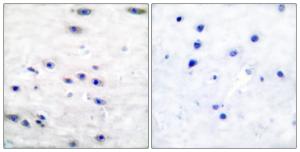 Immunohistochemical analysis of paraffin-embedded human brain tissue using Anti-Tyrosine Hydroxylase Antibody. The right hand panel represents a negative control, where the antibody was pre-incubated with the immunising peptide