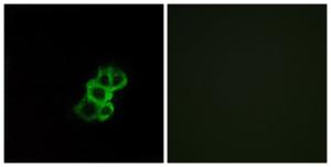 Immunofluorescence analysis of MCF7 cells using Anti-OR8B4 Antibody. The right hand panel represents a negative control, where the Antibody was pre-incubated with the immunising peptide