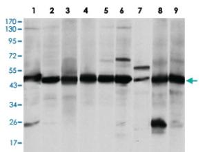 Anti-ASS1 Mouse Monoclonal Antibody [clone: 2B10]