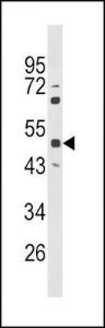 Anti-PAX6 Rabbit Polyclonal Antibody (HRP (Horseradish Peroxidase))