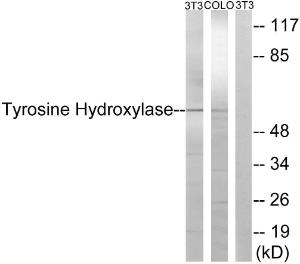 Western blot analysis of lysates from NIH/3T3/COLO cells, treated with Forskolin 40nM 30' using Anti-Tyrosine Hydroxylase Antibody. The right hand lane represents a negative control, where the antibody is blocked by the immunising peptide