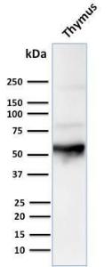 Western blot analysis of human thymus tissue lysate using Anti-Cytokeratin 10 Antibody [LH2]