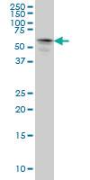 Anti-STK33 Mouse Monoclonal Antibody [clone: 4A12]