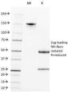 SDS-PAGE analysis of Anti-CD2 Antibody [LFA2/600] under non-reduced and reduced conditions; showing intact IgG and intact heavy and light chains, respectively. SDS-PAGE analysis confirms the integrity and purity of the antibody