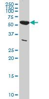 Anti-PKM Mouse Monoclonal Antibody [clone: 5D2-3B3]