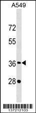 Anti-CREBZF Rabbit Polyclonal Antibody (FITC (Fluorescein Isothiocyanate))