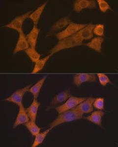 Immunofluorescence analysis of NIH-3T3 cells using Anti-Cyclin B2 / CCNB2 Antibody [ARC1435] (A306931) at a dilution of 1:100 (40x lens). DAPI was used to stain the cell nuclei (blue)