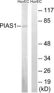 Western blot analysis of lysates from HUVEC cells using Anti-PIAS1 Antibody. The right hand lane represents a negative control, where the Antibody is blocked by the immunising peptide