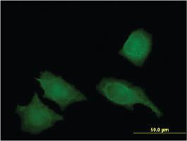 Anti-IREB2 Mouse Monoclonal Antibody [clone: 1F3]