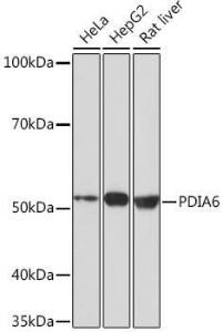 Western blot analysis of extracts of various cell lines, using Anti-PDIA6 Antibody [ARC0944] (A306932) at 1:1,000 dilution. The secondary antibody was Goat Anti-Rabbit IgG H&L Antibody (HRP) at 1:10,000 dilution.