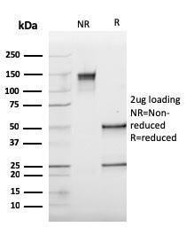 SDS-PAGE analysis of Anti-Cathepsin K Antibody [CTSK/2793] under non-reduced and reduced conditions; showing intact IgG and intact heavy and light chains, respectively. SDS-PAGE analysis confirms the integrity and purity of the antibody.