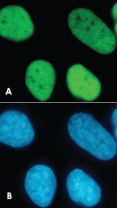 Anti-Histone H3 (K9/14ac) Rabbit Polyclonal Antibody