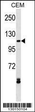 Anti-MECOM Rabbit Polyclonal Antibody (AP (Alkaline Phosphatase))