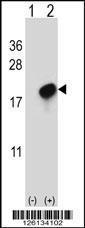 Anti-CMTM7 Rabbit Polyclonal Antibody (Biotin)