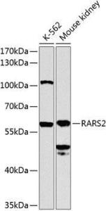 Anti-RARS2 antibody