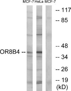 Western blot analysis of lysates from MCF-7 and HeLa cells using Anti-OR8B4 Antibody. The right hand lane represents a negative control, where the Antibody is blocked by the immunising peptide