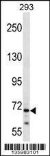 Anti-CEP72 Rabbit Polyclonal Antibody (AP (Alkaline Phosphatase))