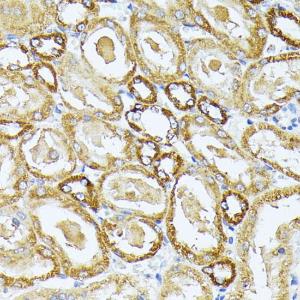 Immunohistochemistry analysis of paraffin-embedded rat kidney using Anti-Complex IV Antibody (A308092) at a dilution of 1:100 (40x lens). Perform microwave antigen retrieval with 10 mM PBS buffer pH 7.2 before commencing with IHC staining protocol.