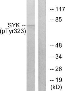 Western blot analysis of lysates from HT29 cells using Anti-SYK (phospho Tyr323) Antibody. The right hand lane represents a negative control, where the antibody is blocked by the immunising peptide.