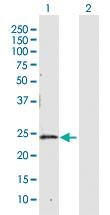 Anti-CBR4 Rabbit Polyclonal Antibody