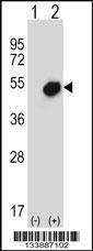 Anti-NR0B1 Rabbit Polyclonal Antibody (FITC (Fluorescein Isothiocyanate))