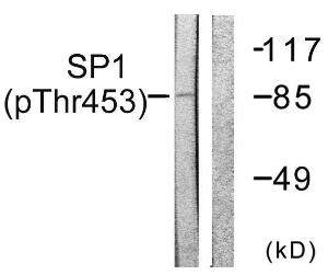 Western blot analysis of lysates from A549 cells using Anti-SP1 (phospho Thr453) Antibody. The right hand lane represents a negative control, where the antibody is blocked by the immunising peptide.