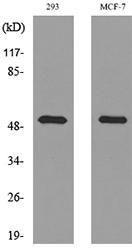 Western blot analysis of lysate from 293, MCF 7 cells using Anti-TYMP Antibody