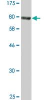 Anti-ACD Mouse Monoclonal Antibody [clone: 1C11-1A7]