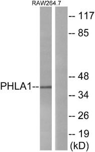 Anti-PHLA1 antibody