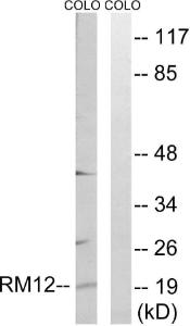 Anti-MRPL12 Rabbit Polyclonal Antibody