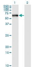 Anti-STK33 Mouse Monoclonal Antibody [clone: 4A12]