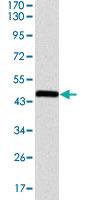 Anti-ASS1 Mouse Monoclonal Antibody [clone: 2B10]