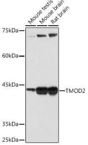 Western blot analysis of extracts of various cell lines, using Anti-Tropomodulin 2 Antibody [ARC2318] (A306934) at 1:1,000 dilution